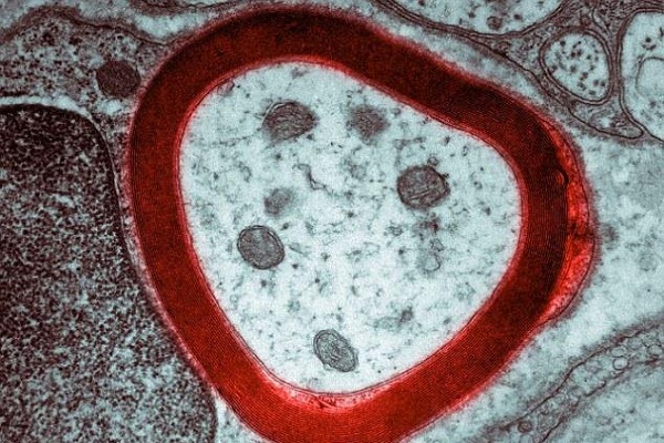 استعدادیابی در موسیقی با ماده چرب گوش استعدادیابی در موسیقی با ماده چرب گوش