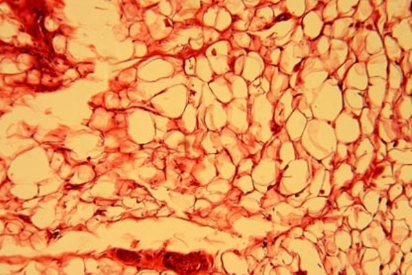 شناسایی کلاس جدیدی از چربی ها در بدن شناسایی کلاس جدیدی از چربی ها در بدن