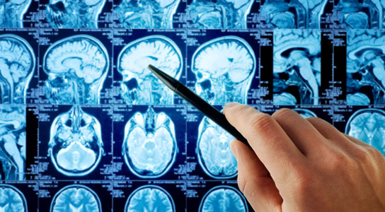 نانو ذرات زیست تخریب پذیر برای درمان سرطان مغز نانو ذرات زیست تخریب پذیر برای درمان سرطان مغز