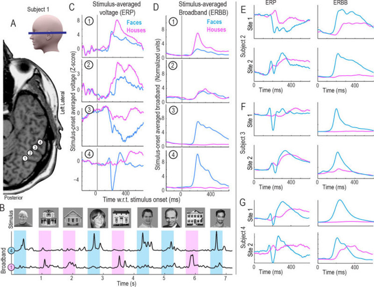 تکنیکی جدید برای خواندن ذهن انسان با سرعت بالا تکنیکی جدید برای خواندن ذهن انسان با سرعت بالا