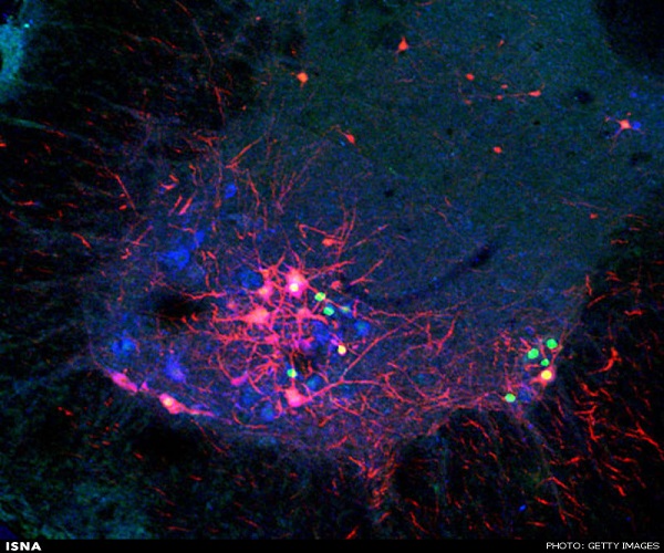 نقشهبرداری از مغز با ویروس هاری! نقشهبرداری از مغز با ویروس هاری!