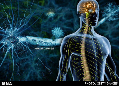 درمان نویدبخش اماس با سلولهای بنیادی درمان نویدبخش اماس با سلولهای بنیادی