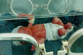 تکذیب شایعات درباره مرگ نوزاد صومعهسرایی تکذیب شایعات درباره مرگ نوزاد صومعهسرایی