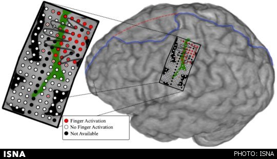 کنترل دقیق انگشتان مصنوعی با امواج مغزی کنترل دقیق انگشتان مصنوعی با امواج مغزی