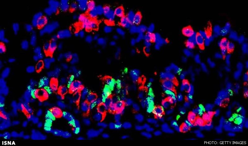 تولید معده کوچک آزمایشگاهی که انسولین تولید میکند تولید معده کوچک آزمایشگاهی که انسولین تولید میکند