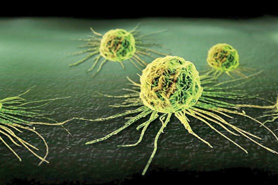 روشی تازه برای درمان سرطان سینه روشی تازه برای درمان سرطان سینه