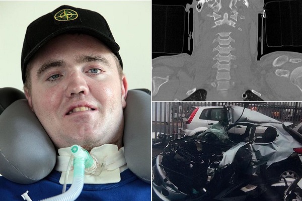 بازگشت به زندگی مردی که سرش قطع شد بازگشت به زندگی مردی که سرش قطع شد