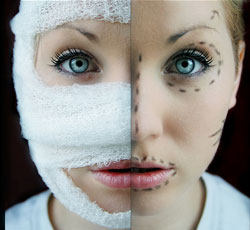 افزایش جراحی های زیبایی غیر استاندارد در ایران افزایش جراحی های زیبایی غیر استاندارد در ایران