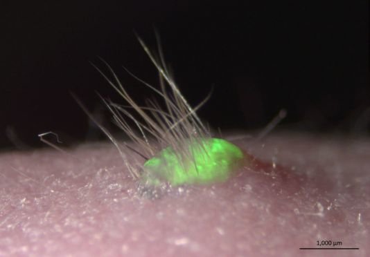 تولید پوست طبیعی برای درمان سوختگیهای شدید تولید پوست طبیعی برای درمان سوختگیهای شدید