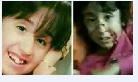 آرزوی دختری که با قمه پدرش شکنجه شد: می خواهم پیانیست شوم/ می خواهم زنده بمانم آرزوی دختری که با قمه پدرش شکنجه شد: می خواهم پیانیست شوم/ می خواهم زنده بمانم