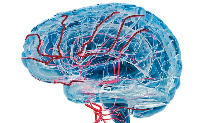 زوال عقل عروقی و دانستنی‌هایی درباره آن