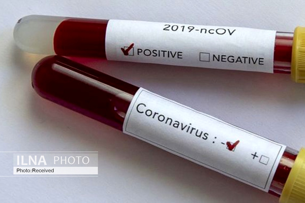 ثبت اولین مورد ابتلا به ویروس کرونا در الجزایر