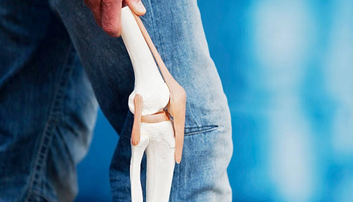 عاداتی که به بهبود آرتروز کمک می‌کنند