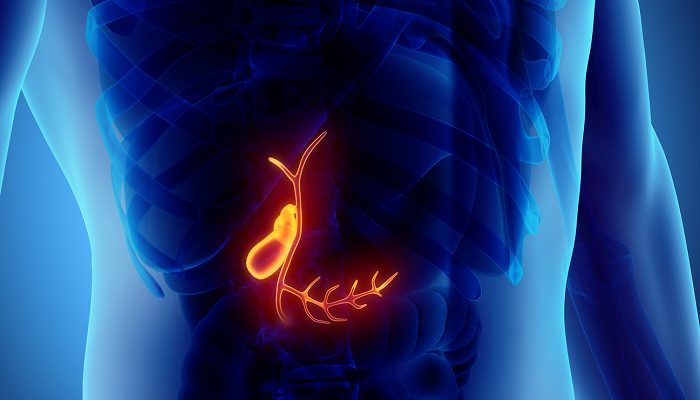 وقتی کیسه صفرا حمله می‌کند!