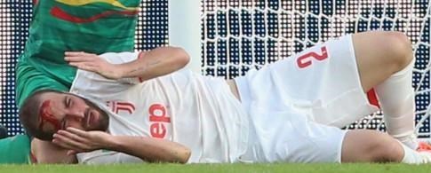 مهاجم یوونتوس راهی بیمارستان شد (+عکس) مهاجم یوونتوس راهی بیمارستان شد (+عکس)