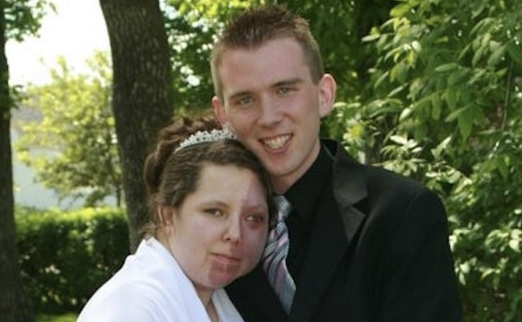 ماجرای ازدواج زنی که به دلیل ماه گرفتگی هیولا خطابش می کردند (+عکس) ماه گرفتگی