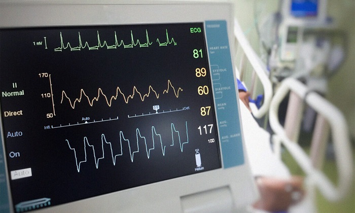 تجمع مایع اطراف قلب؛ از دلایل تا درمان تجمع مایع اطراف قلب؛ از دلایل تا درمان