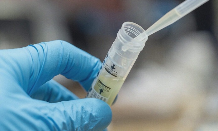 عفونت دستگاه ادراری در برابر عفونت کلیوی: از علائم تا پیشگیری