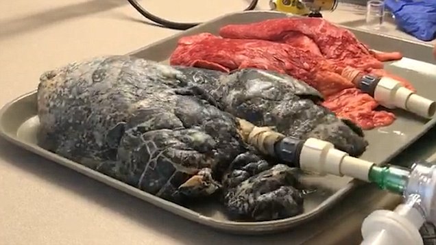 تاثیر سیگار کشیدن بر ریهها به روایت تصویر تاثیر سیگار کشیدن بر ریهها به روایت تصویر