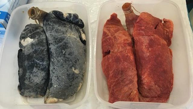 تاثیر سیگار کشیدن بر ریهها به روایت تصویر تاثیر سیگار کشیدن بر ریهها به روایت تصویر