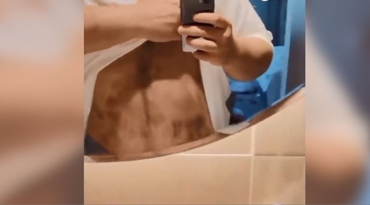 ببینید| ماجرای شایعه ضرب و شتم هالک ایرانی؛ علت کبودی و زخم چه بود؟