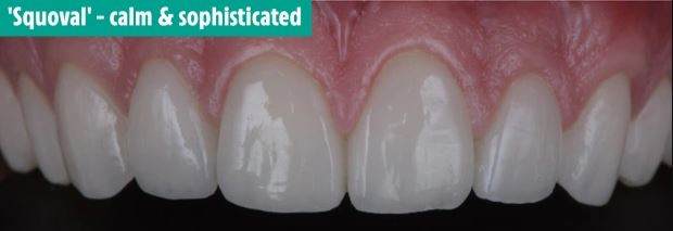 دندان های شما در مورد شخصیت تان چه می گویند؟ دندان های شما در مورد شخصیت تان چه می گویند؟