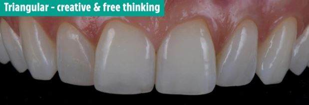 دندان های شما در مورد شخصیت تان چه می گویند؟ دندان های شما در مورد شخصیت تان چه می گویند؟