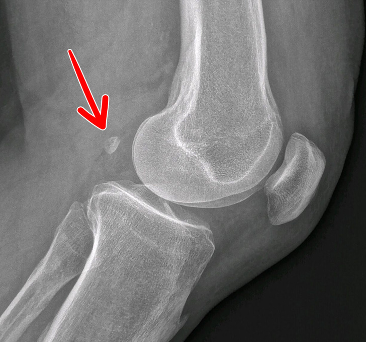 10 راز عجیب درباره بدن انسان که نمی دانستید 10 راز عجیب درباره بدن انسان که نمی دانستید