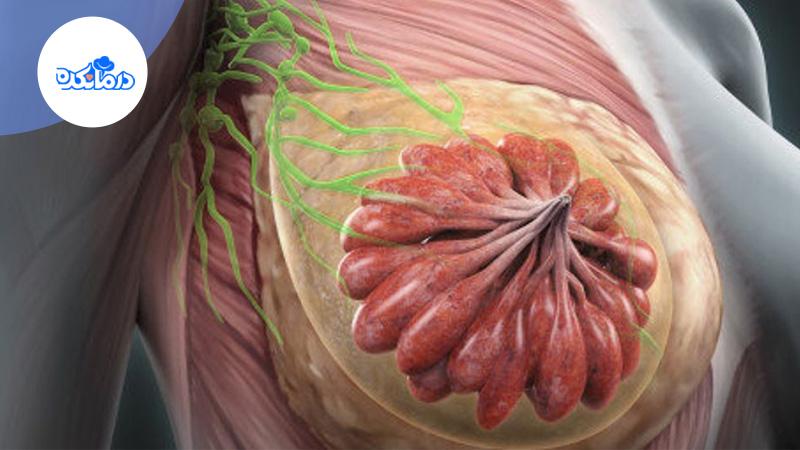 ماستیت چیست؟ آشنایی با علائم، علت و درمان بیماری ماستیت چیست؟ آشنایی با علائم، علت و درمان بیماری