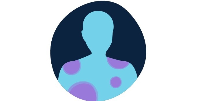 سرطان خون و همه چیز درباره نشانه های آن