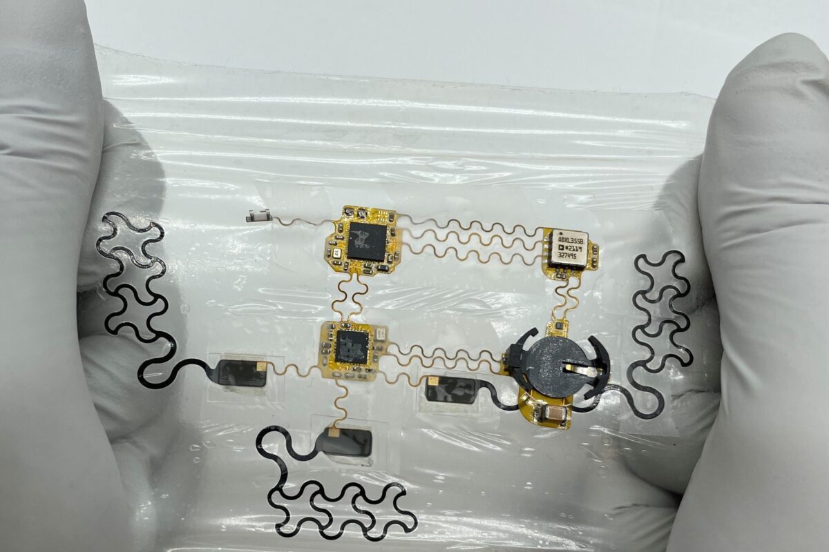 تحول در نظارت بر سلامت قلب با ئی-تتو تحول در نظارت بر سلامت قلب با ئی-تتو