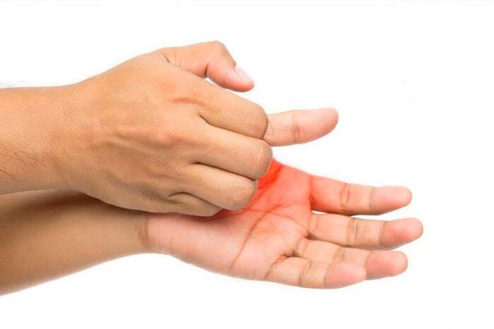 خارش کف دست خارش کف دست