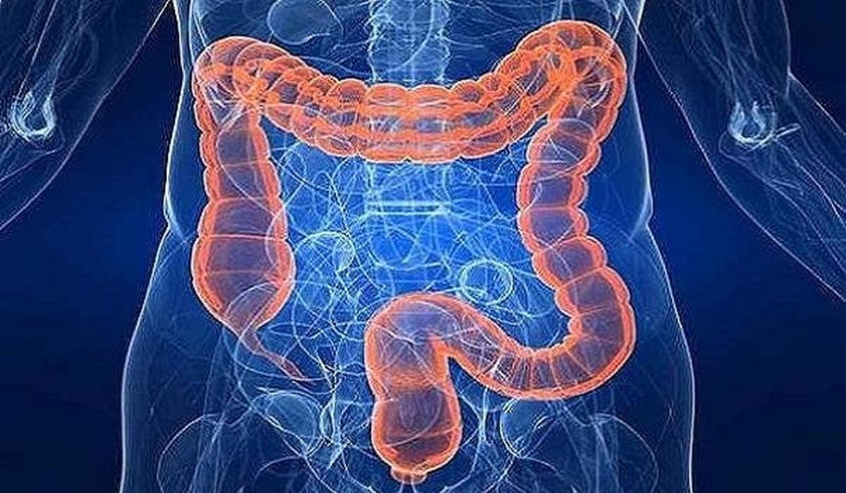 ۵ ویتامین برای پیشگیری از یبوست