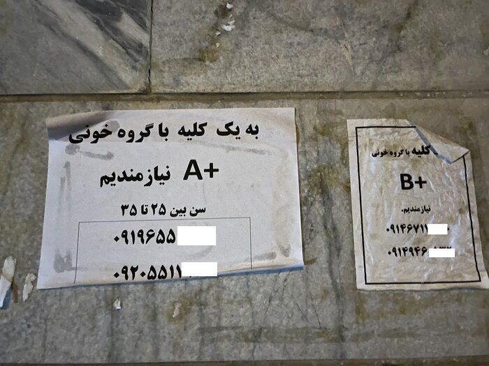 عضو بدن شما را خریداریم! / فروش دلاری کلیه با سفر ایرانی ها به ترکیه و عراق عضو بدن شما را خریداریم! / فروش دلاری کلیه با سفر ایرانی ها به ترکیه و عراق