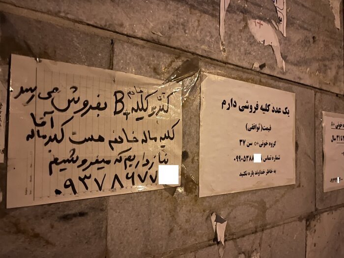 عضو بدن شما را خریداریم! / فروش دلاری کلیه با سفر ایرانی ها به ترکیه و عراق عضو بدن شما را خریداریم! / فروش دلاری کلیه با سفر ایرانی ها به ترکیه و عراق